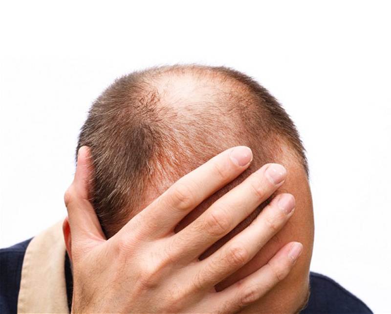 can vellus hair regrow